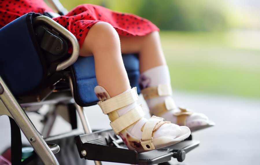Ein Mädchen sitzt in einem Rollstuhl. An ihren Beinen trägt sie Orthesen. 