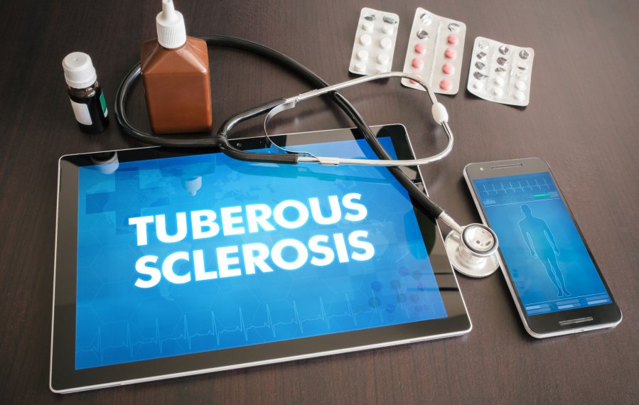 Auf einem Tisch liegt ein Tablet mit dem Spruch "Tuberous Sclerosis", ein Smartphone, ein Stethoskop und Medikamente.