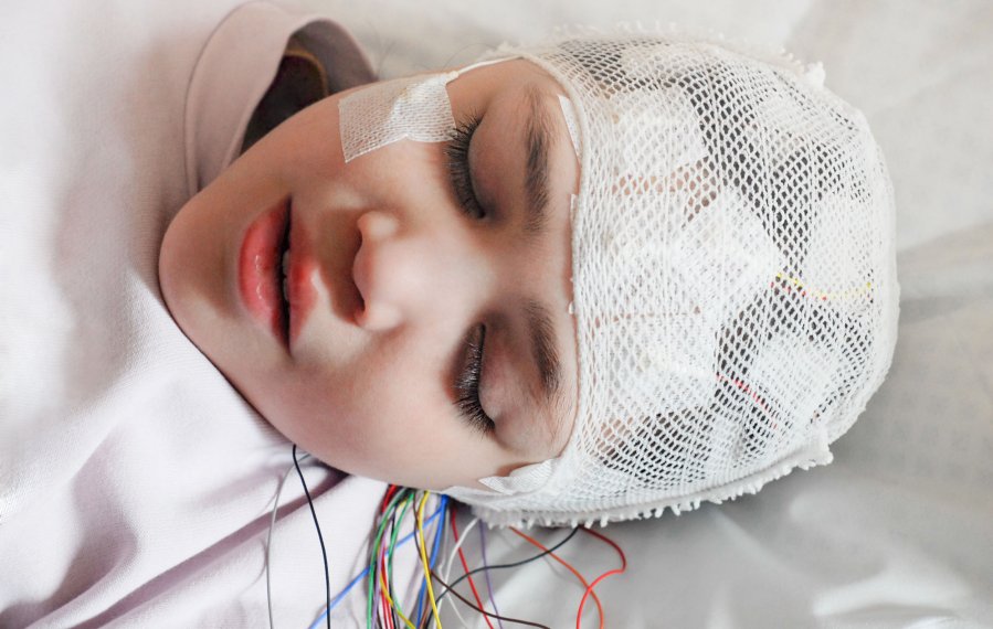 Ein Mädchen ist am Kopf mit Elektroden verkabelt und liegt auf einer Liege. Der Bildausschnitt zeigt nur den Kopf des Mädchens. Sie hat die Augen geschlossen.
