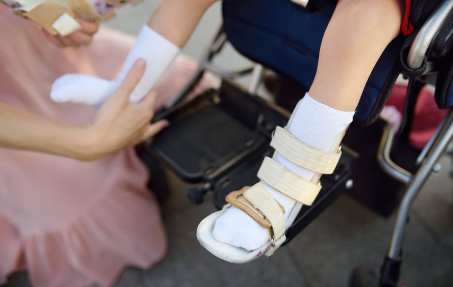 Eine Frau legt einem Kind im Rollstuhl eine Orthese am rechten Fuß an.
