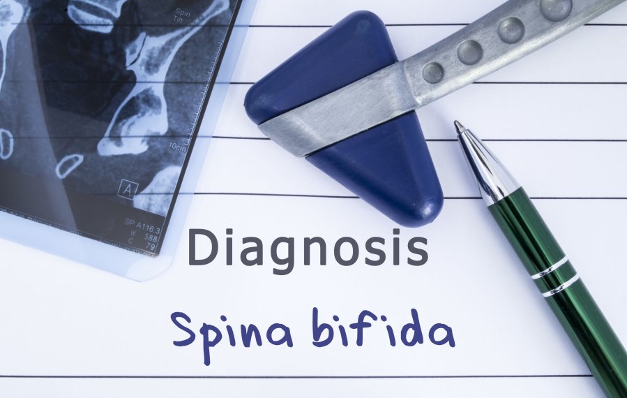 Ein Teil eines Röntgenbildes, ein Kugelschreiber und ein medizinischer Hammer, sowie der Schriftzug „Diagnosis Spinda bifida“ .