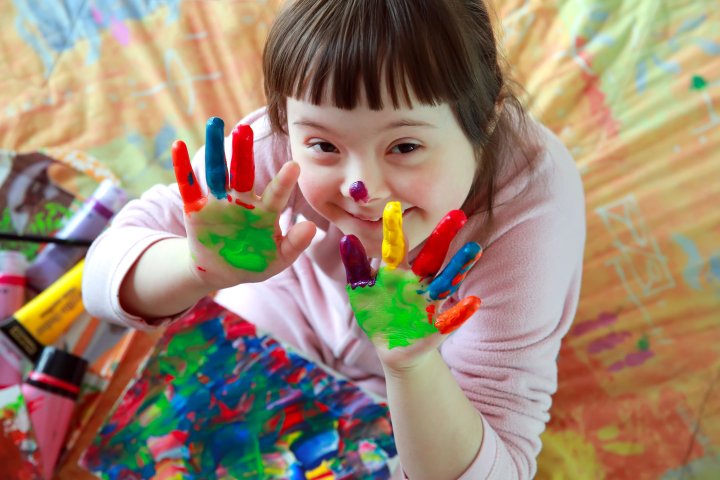 Diagnose Down Syndrom Und Nun Fachbeitrage Intakt