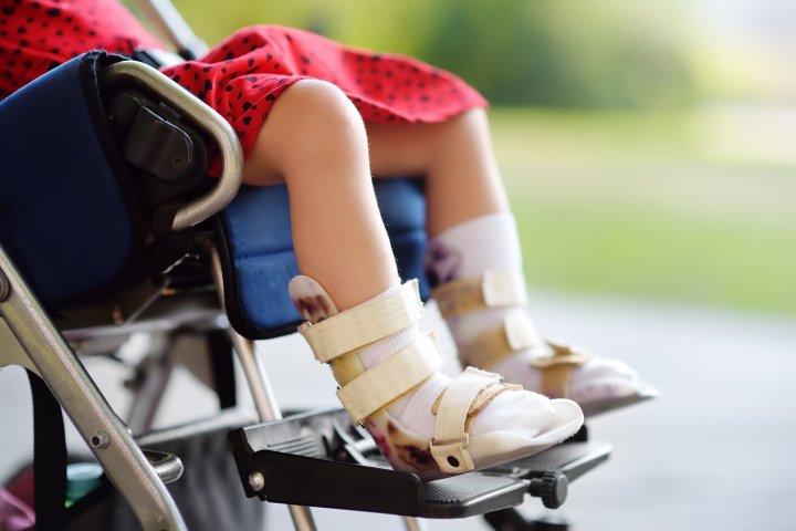 AMC - ein Mädchen sitzt in einem Rollstuhl. An ihren Beinen trägt sie Orthesen.