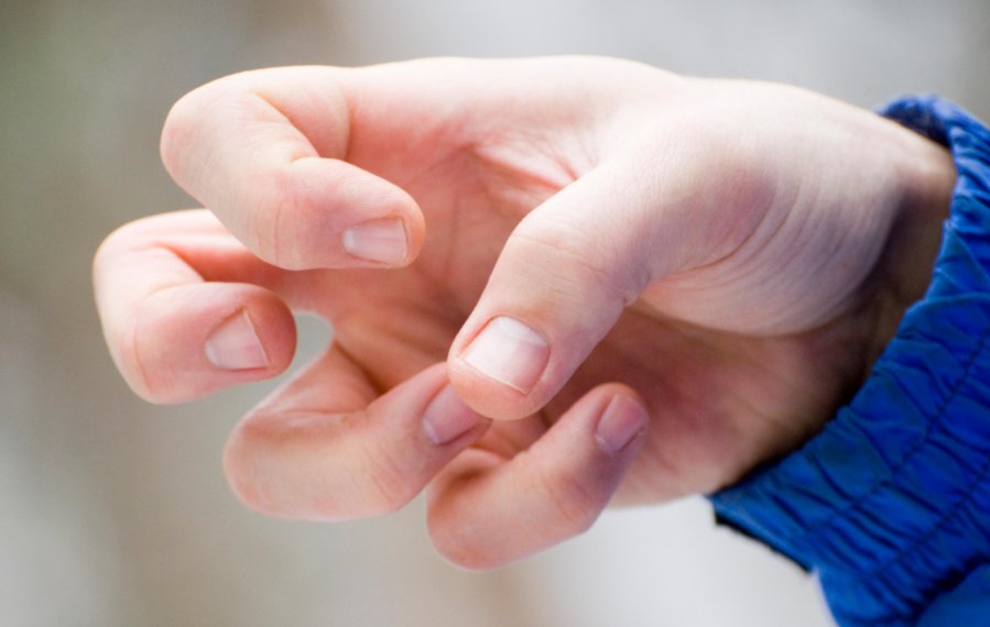 Eine Hand verkrampfte mit zusammen gezogenen Fingern.